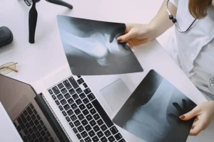 Opšta bolnica ostvarila izuzetne rezultate u ortopediji tokom ove godine