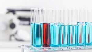 Poboljšana dostupnost laboratorije za pacijente u Sivcu i Crvenki